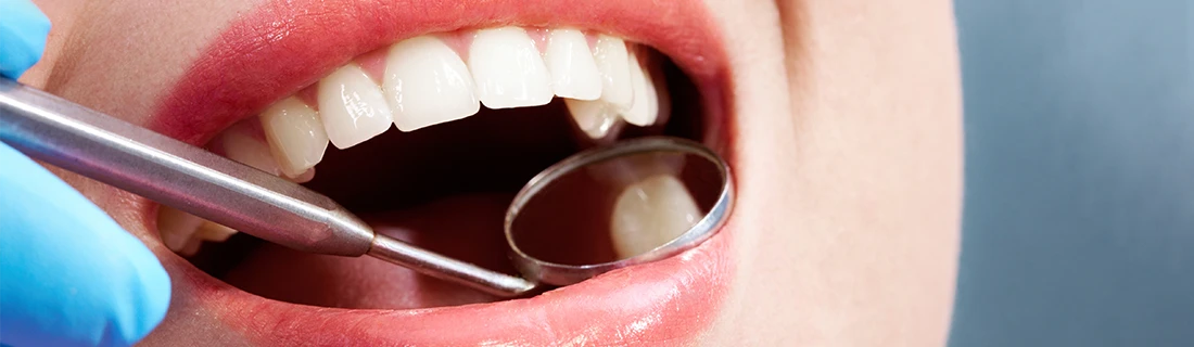 Dentist Using A Mirror To Examine The Application Of Fluoride To a Tooth