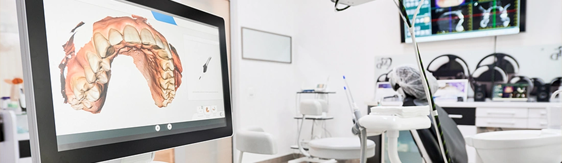 Intraoral 3DCT Scan Results On Screen